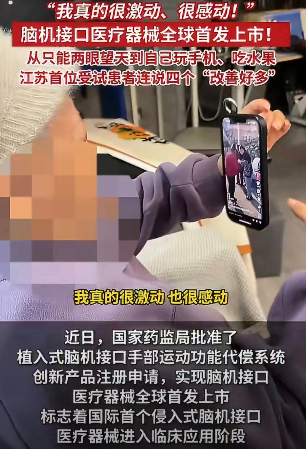 截瘫女子植入脑机1年后能刷手机了 截瘫女子植入脑机接口一年，从无法握手机到自如刷