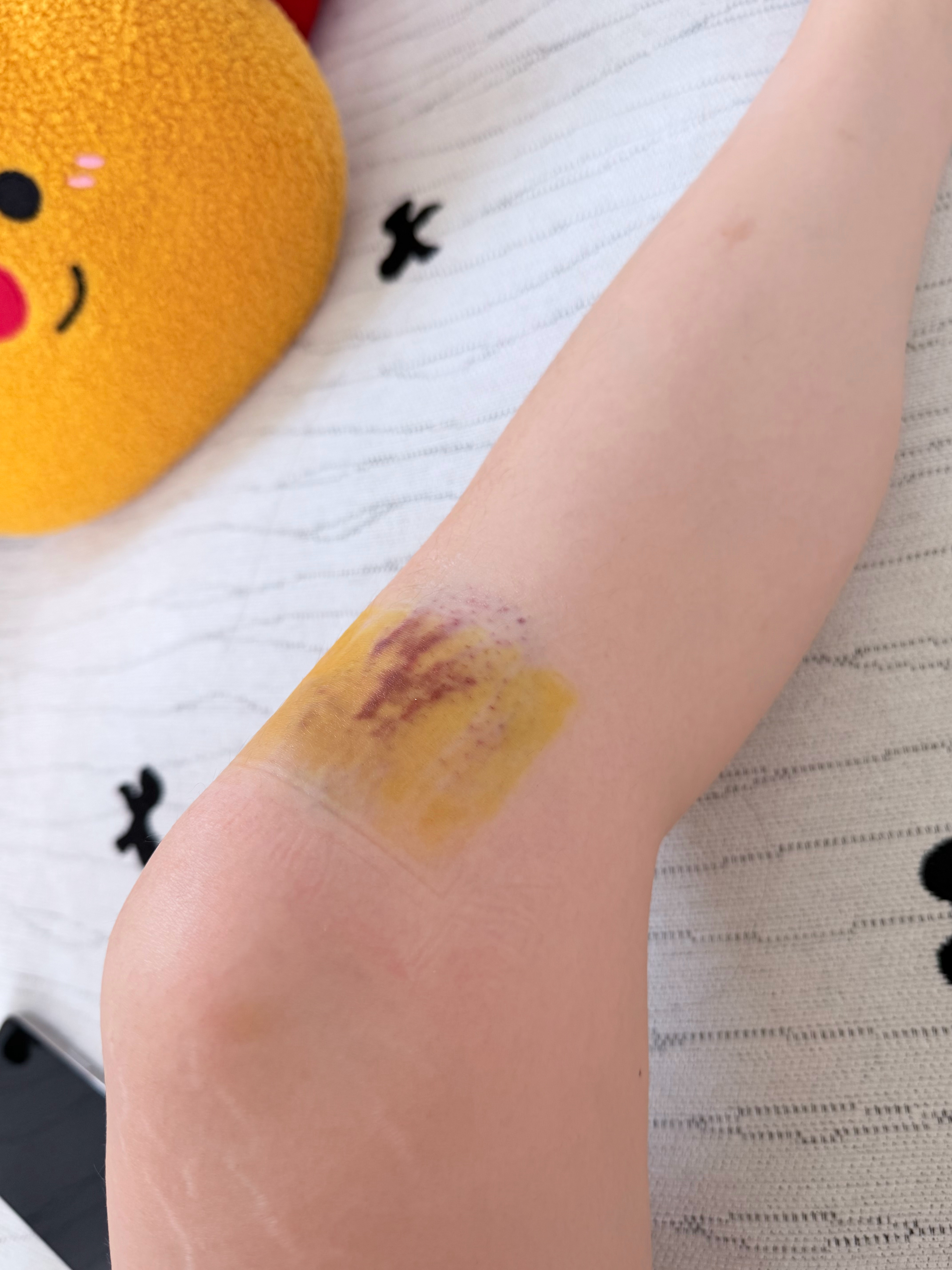 报告这是小笨佩昨天的摔况 没大事 就是穿短裤会丑了起床才来及看昨天视频的评论心里