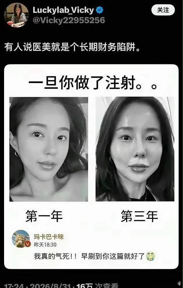 医美是一个花钱很多的项目，真不是一般人能做的。 ​​​