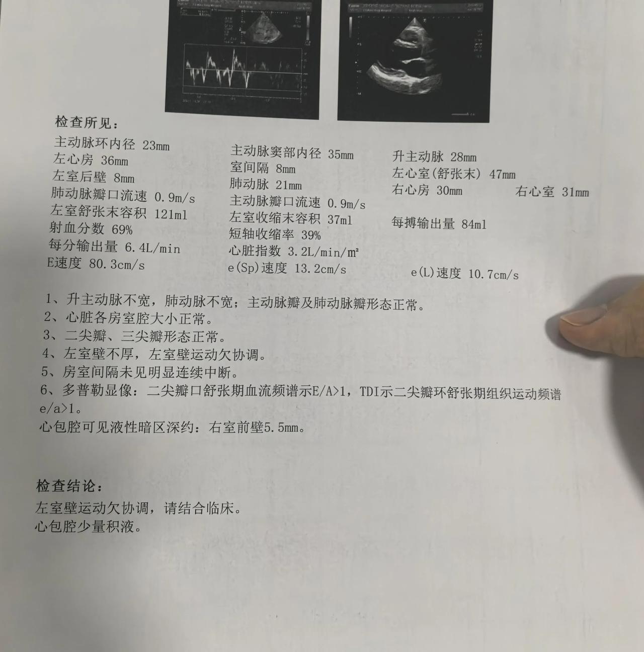 老公快30了，前段时间突然说心绞痛，之前也就偶尔微微的痛，也没管它，今天去做了检