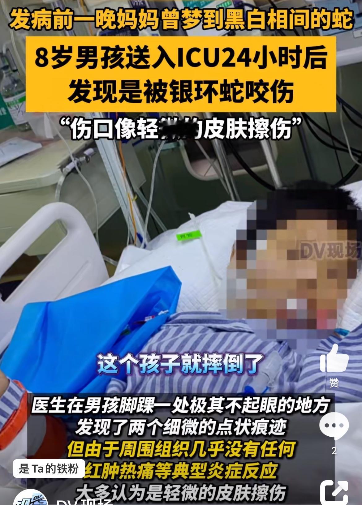 韶关一8岁小孩水沟边摔一跤进入ICU，幸得良医根据蛛丝马迹判断出是被银环蛇咬，终
