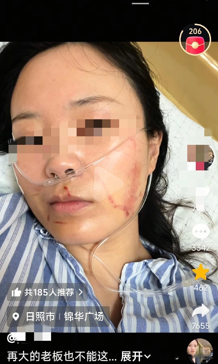 山东日照的刘女士发视频说，自己在本地的一个服装超市里，给孩子买了一条裤子，裤子大