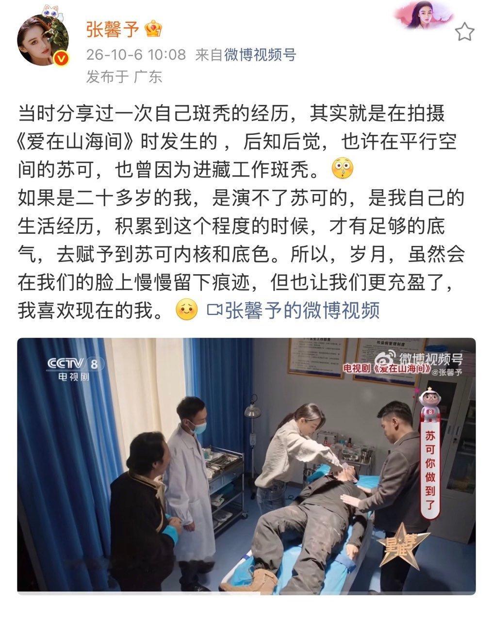 张馨予我喜欢现在的我张馨予曾经历过斑秃张馨予：我喜欢现在的我 ​​​