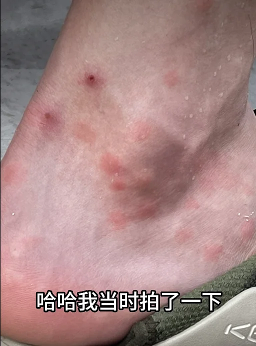 王一博招蚊子😢