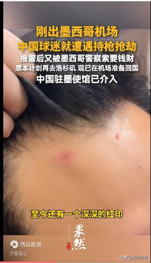 中国球迷刚出墨西哥机场，就被人用枪顶着脑袋，电脑、现金、手表全被抢走，额头上至今
