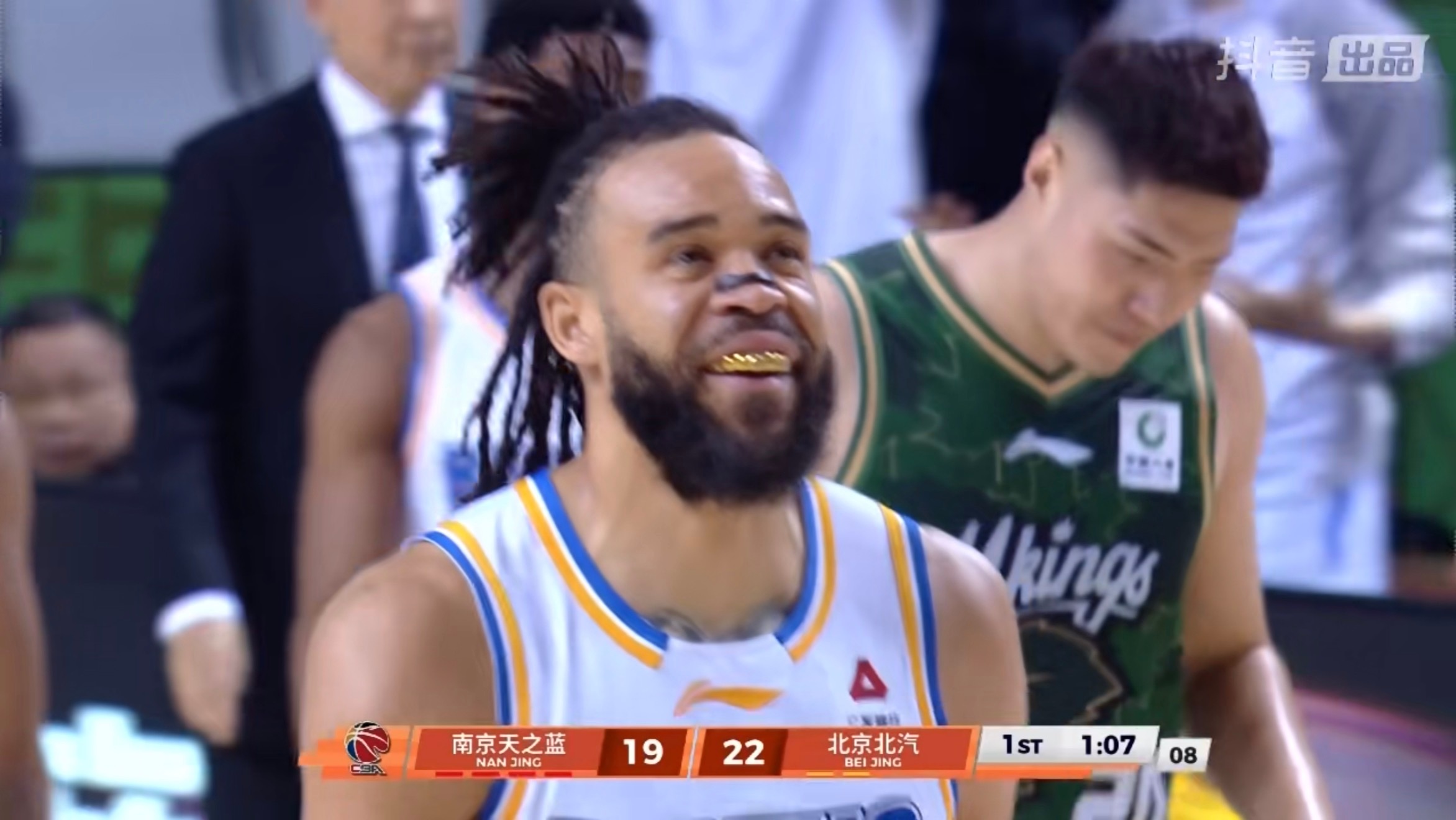 这大“金牙”同曦男篮vs北京男篮