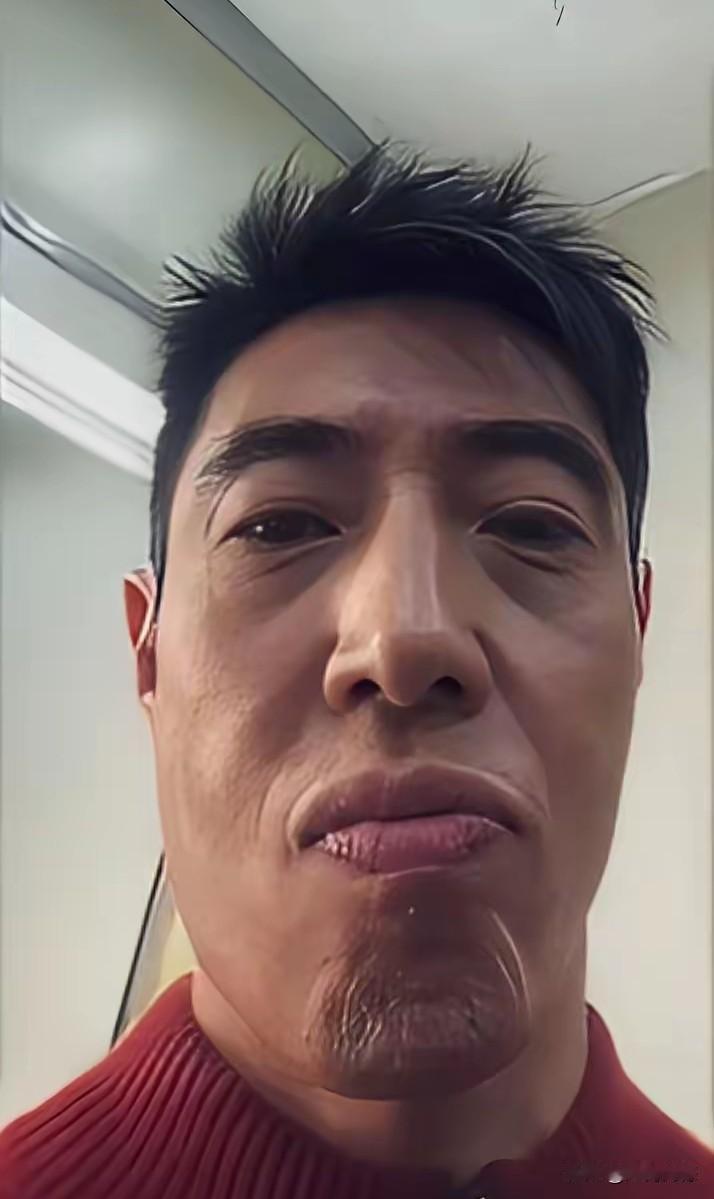 撒贝宁为什么要照出这样的照片？这下巴是怎么弄的？有点影响他的形象了，感觉应该是在