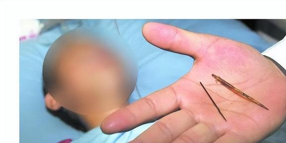 “这是恶魔！”北京，一男子在给儿子洗澡的时候发现，儿子的臀部竟满是针眼，男子遂赶