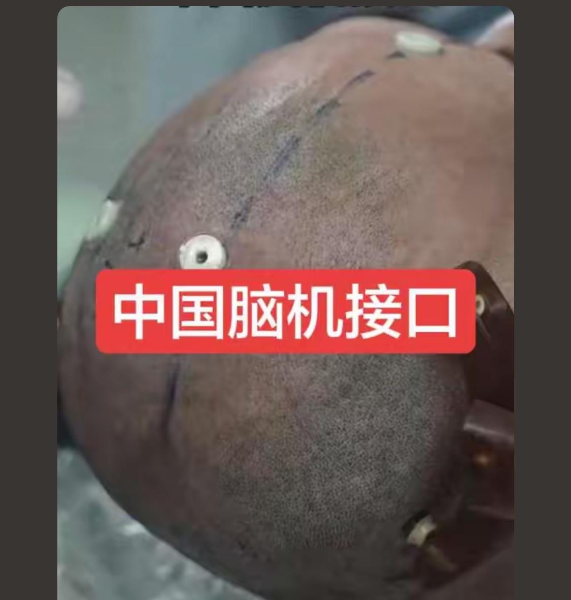 15年前 脑机接口还么有问世，就听说以后每个脑袋上以后会植入芯片，这个时候三战就