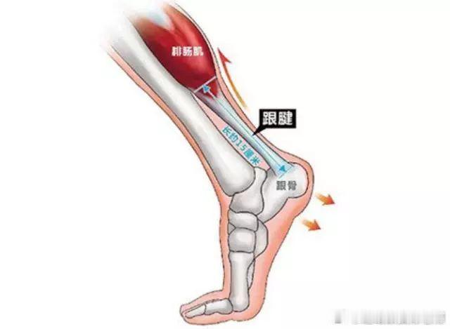 跟腱断裂  今天给大家讲个严重的损伤：跟腱断裂[生病]很多人知道它，都是因为当年