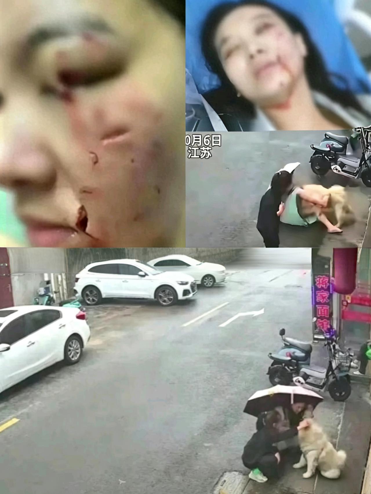 600万赔偿没拿到，反而搭上一张脸：有些“爱心”，真的会要命

这起让人揪心的狗