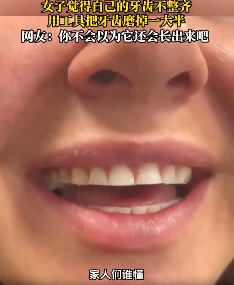 是个狠人！一女子觉得自己的牙齿长短不齐，突然强迫症犯了，用工具把自己的牙齿磨平一