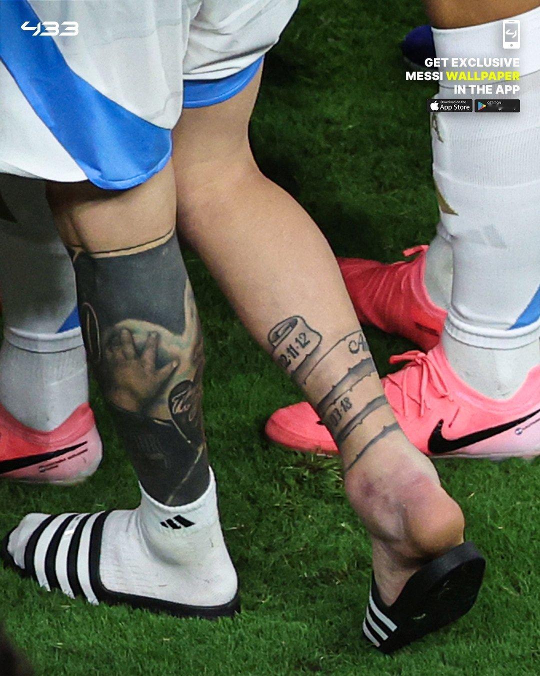 心疼[泪][泪][泪]梅西右脚踝特写，肿成这样了[泪][泪][泪]#梅西[超话]