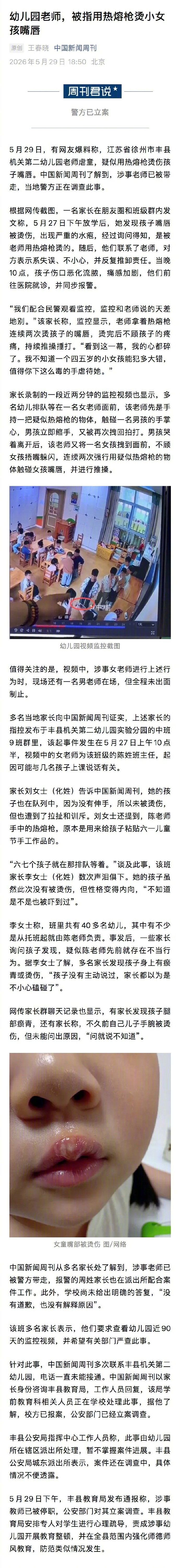 【女童被幼师烫伤另一老师在旁未制止】5月29日，有网友爆料称，江苏省徐州市丰县机