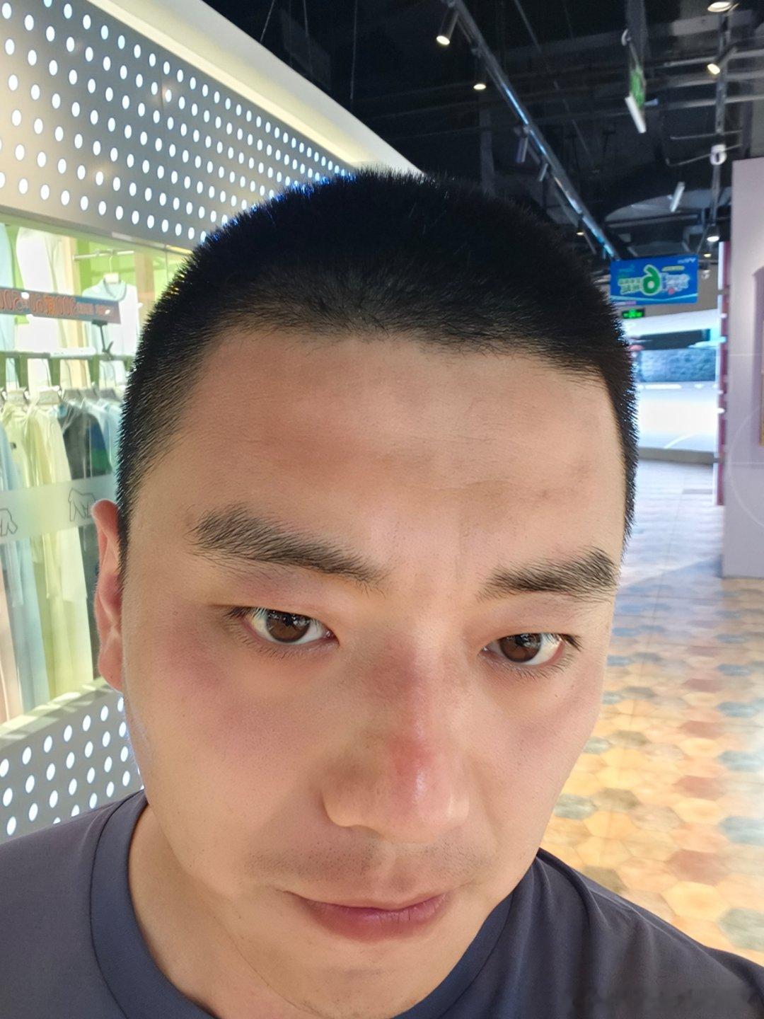 日常都是慢速五公里今天考核一公里着急了差点没给我跑横纹溶解了也晒过敏了