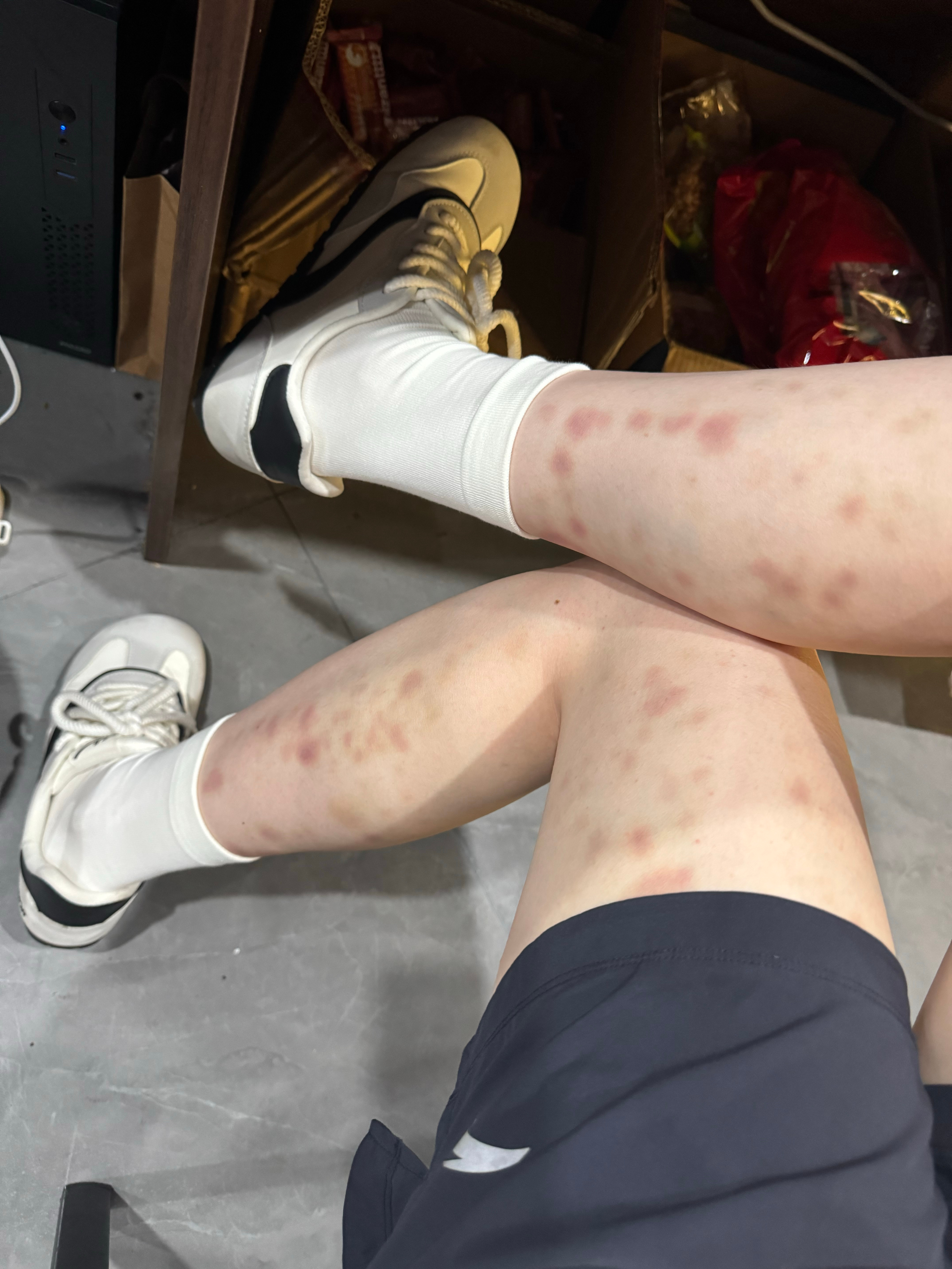 上班上的腿部肌肉酸的要死给自己狠狠滚了一下 