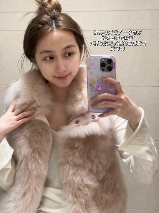 打完太阳穴手机面容识别失败😶