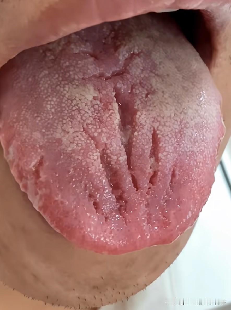 这位大哥不一般，身体垮的不像话了，还想着自己是20出头小伙[强]

前几天门诊的