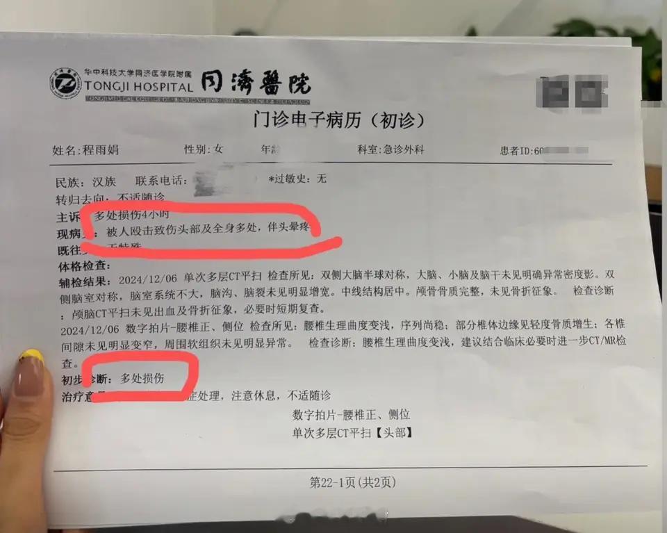 12月8日和9日这两天，知名网红程老师自曝被前夫的爸爸家暴，并讲述了自己的不幸遭