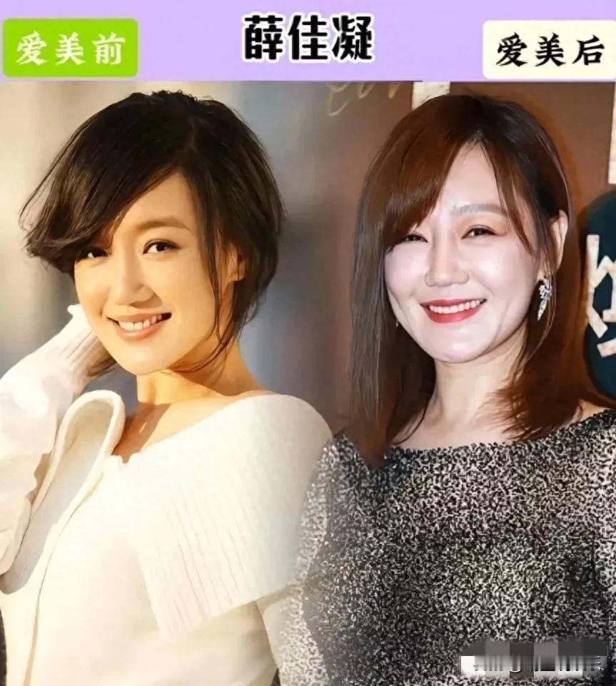 这些女星明明天生丽质，非要想不开去医美，最后适得其反，反而越整越丑。
“医美”这