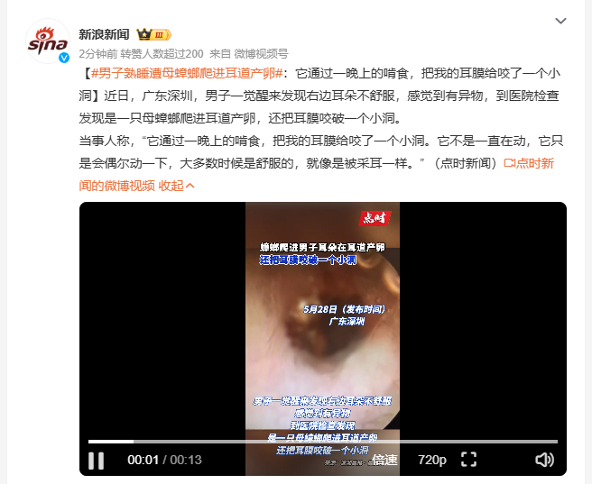 男子熟睡遭母蟑螂爬进耳道产卵 深圳一男子睡醒后右耳不适，到医院检查发现一只母蟑螂