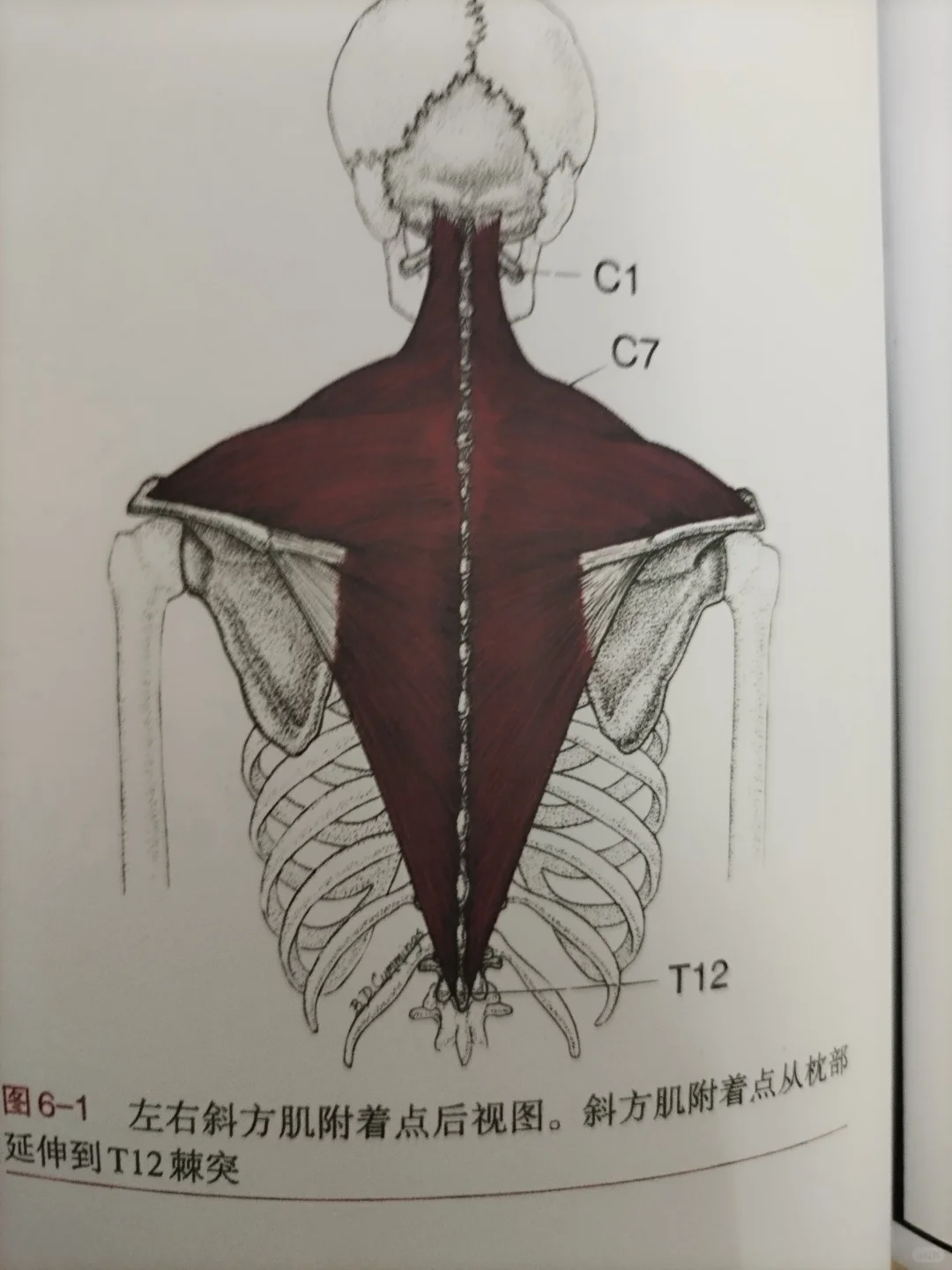 斜方肌最容易出现的问题表现