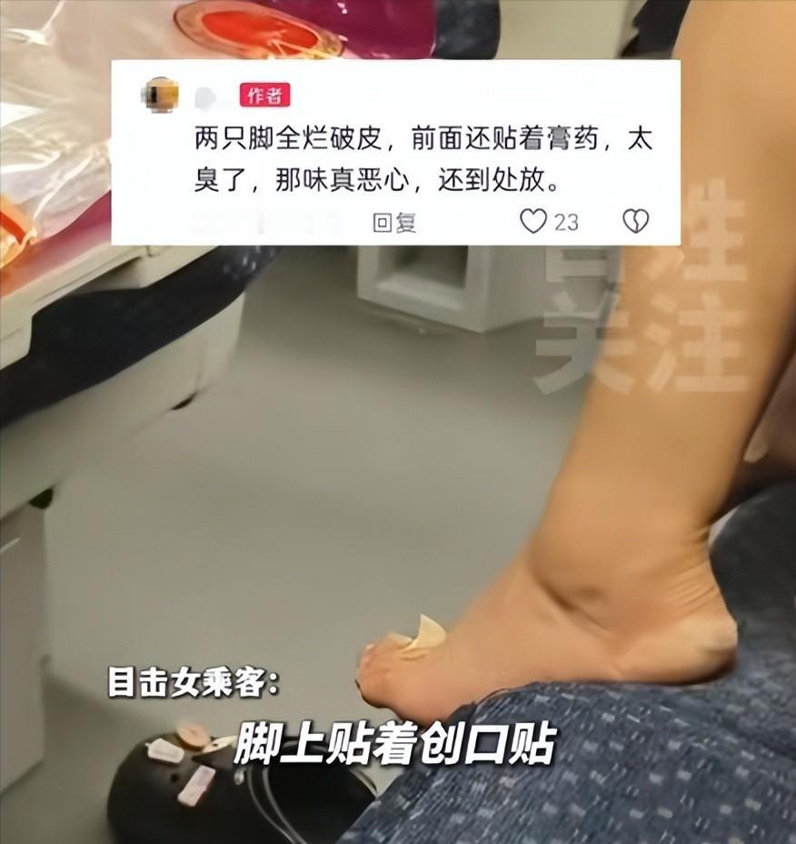 太恶心了！一女子在高铁上脱鞋，还把“溃烂脚”踩在座椅上，旁边乘客被臭的戴两层口罩