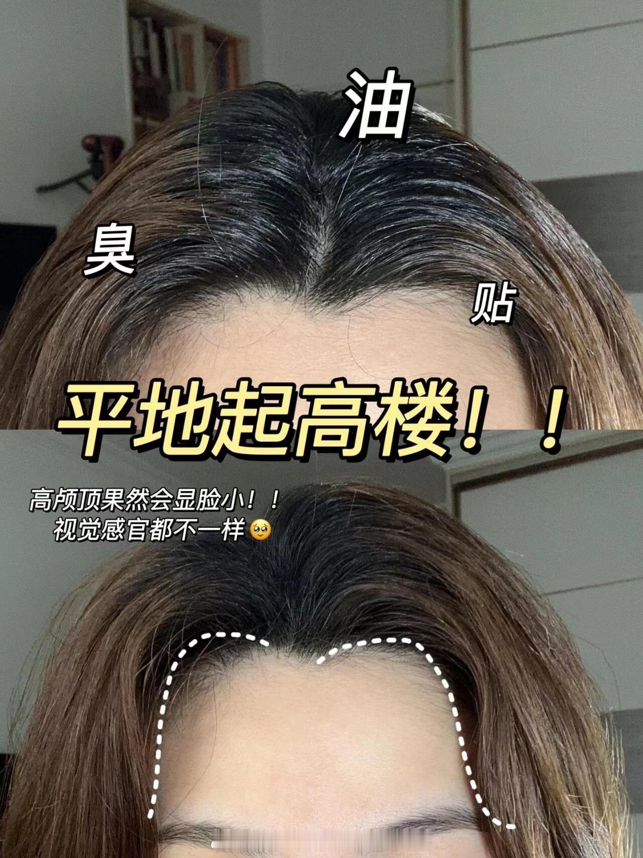 夏天真的离不开干发喷雾油扁塌秒变蓬松头顶的秘密㊙️夏天头发出油更快真的不想每天洗