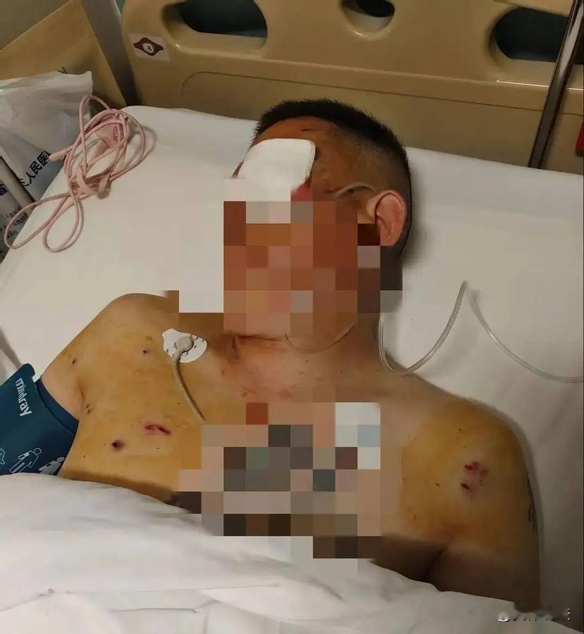 河南郑州，一男子提前预约去银行取了170万元现金，结果刚出门准备上车时，就遇到歹