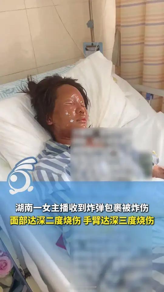 湖南一女主播收到炸弹包裹被炸伤  私自制作爆炸物，制作炸弹判几年？非法制造、买卖