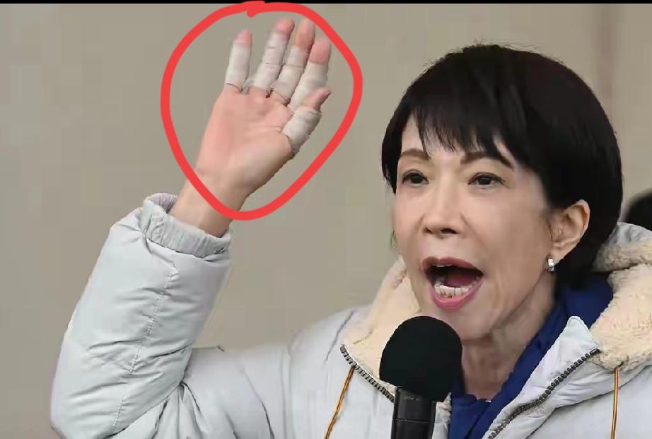 我的手受伤了，不能参加辩论，要去就医，2月1日，本来日本这次选举是日本首相高市早