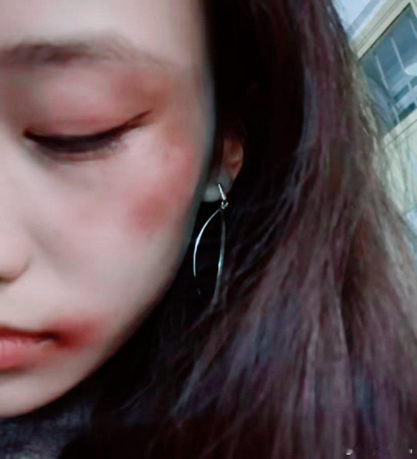 当你被别人打了，一定记住这10个步骤↓↓↓↓1. 马上报警，警察说调解，坚决不同