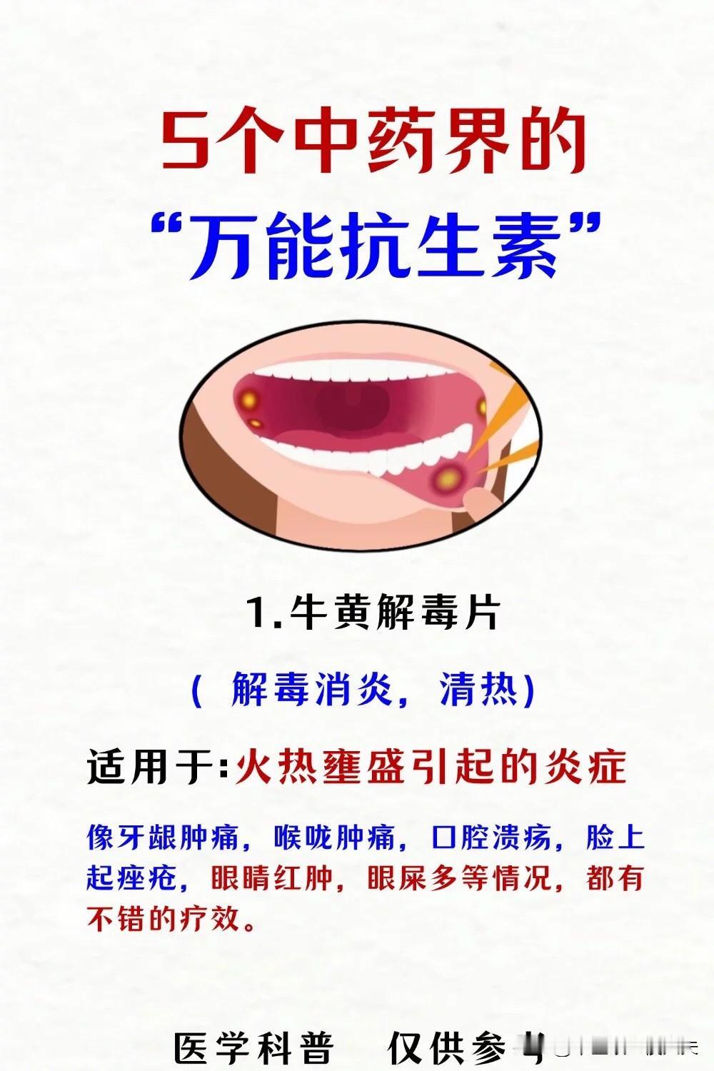 五个中药界的“万能抗生素”#健康养生##肾虚##失眠##炎症##口腔溃疡#

1