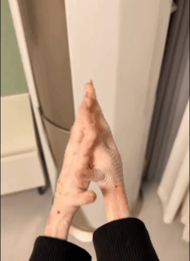 人手咋变成鸡爪了！