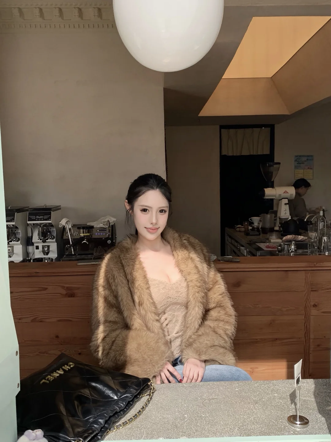 厦门正畸嘴凸内收 厚唇get好看侧脸