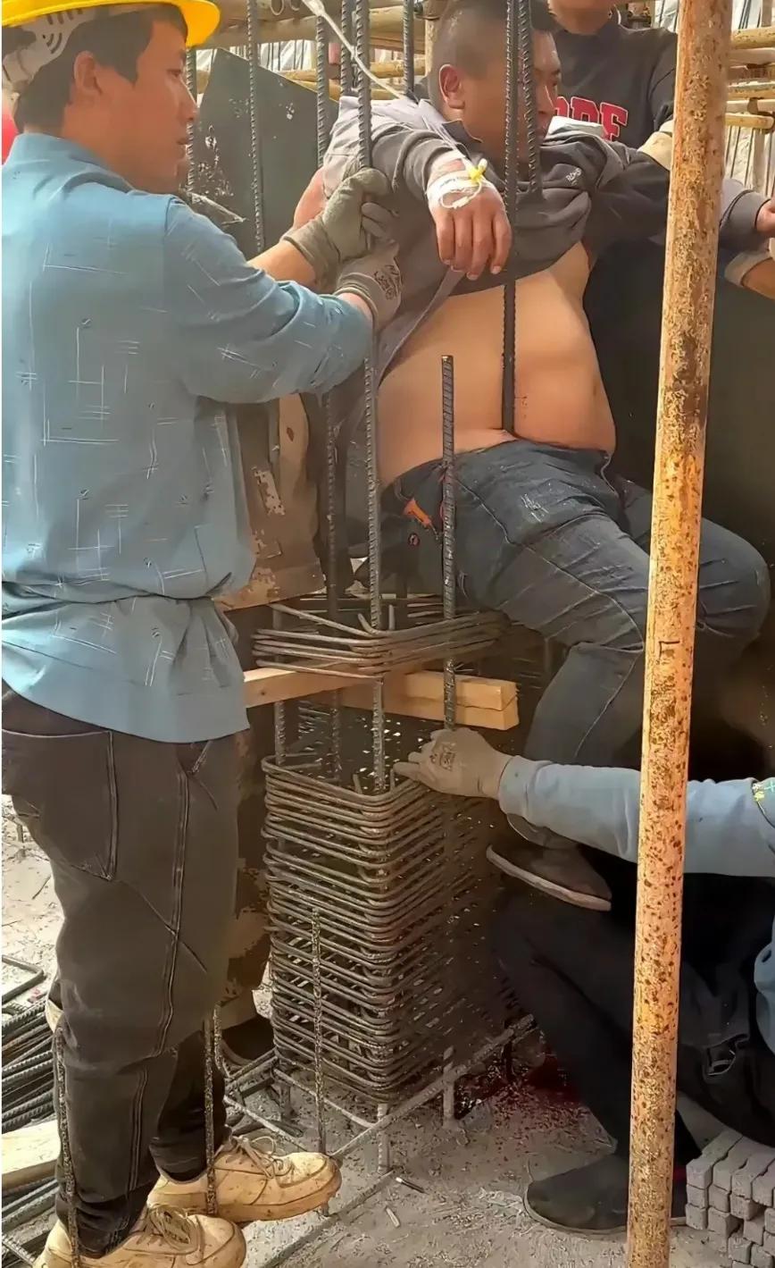 这个男人被几根钢筋穿透身体，这种螺纹钢，怎样才能拔出来呢？希望他能脱离危险，平安