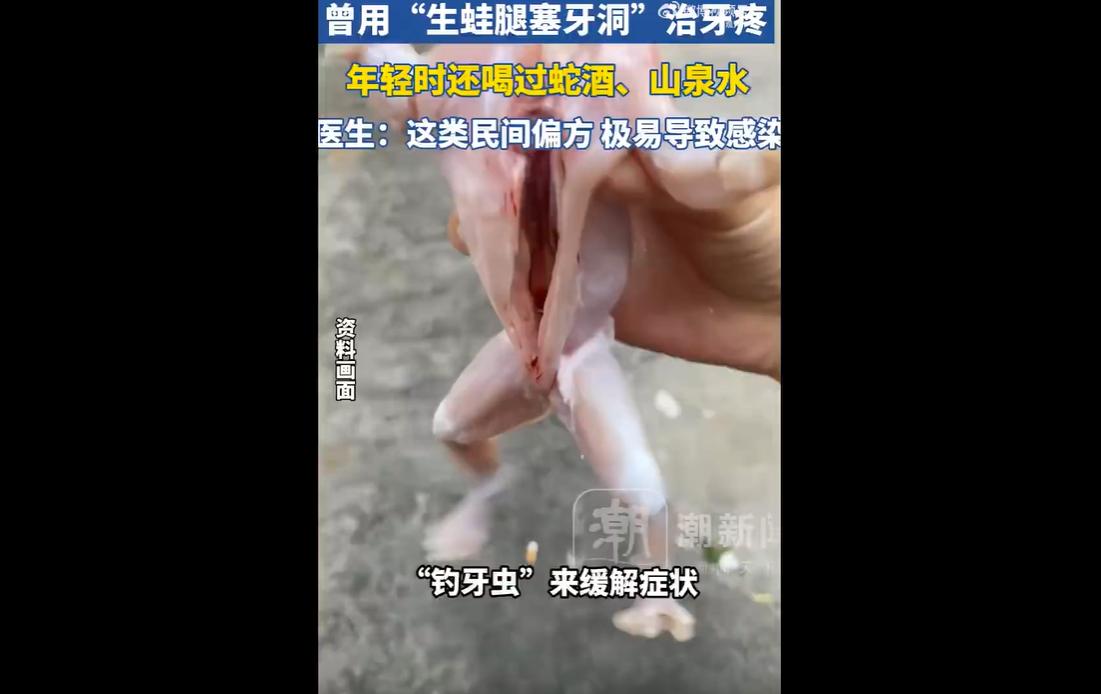 近日，广东梅州的丽姨，被反复抽搐、头皮发麻的症状折磨得苦不堪言，辗转多家医院，一