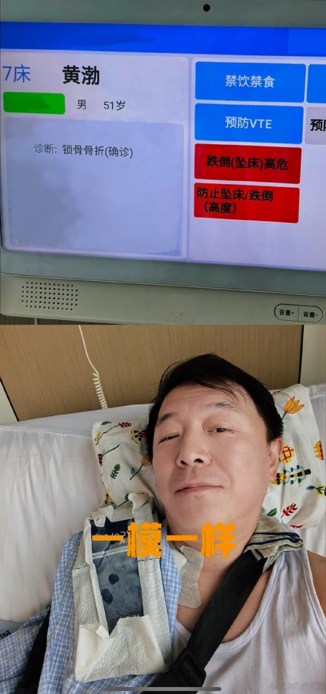 黄渤锁骨骨折原因黄渤说算是用自己的锁骨换了个提醒黄渤发博回应骨折，祝这位乐观的影