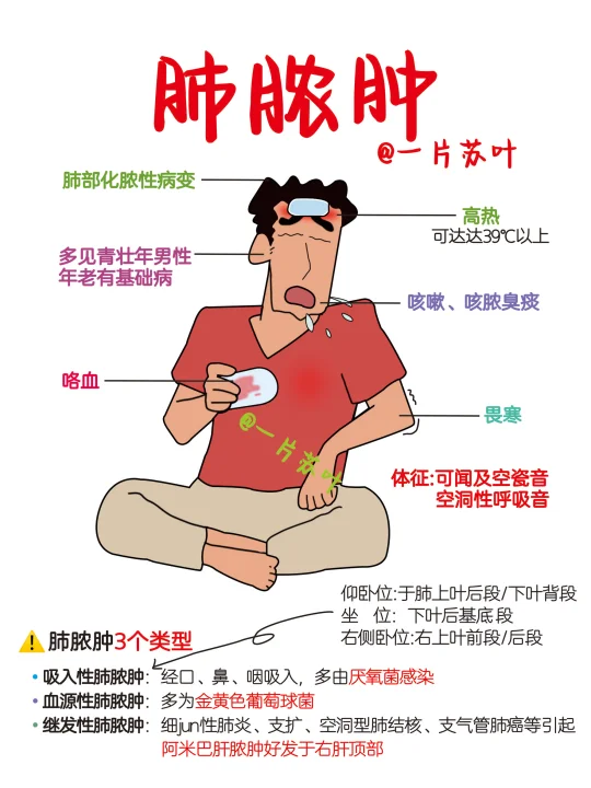 手写笔记✅肺脓肿📕内科护理学‼️