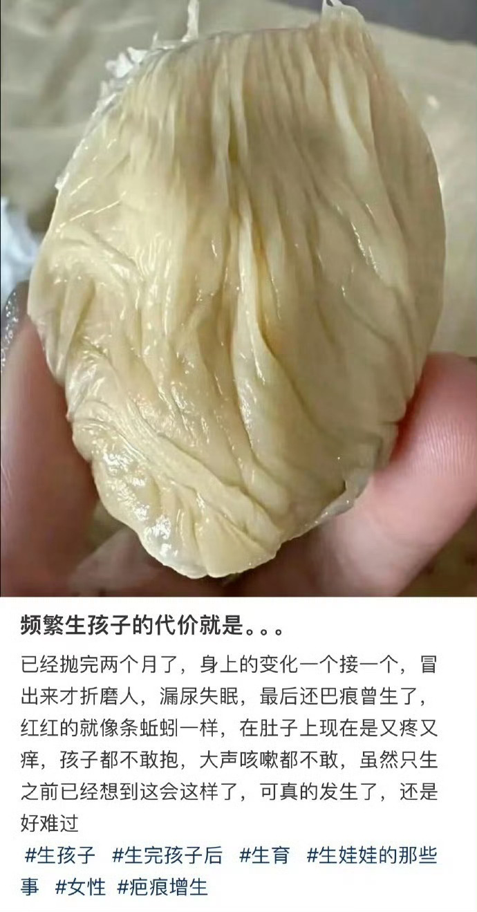 频繁生孩子的代价就是。。。 ​​​