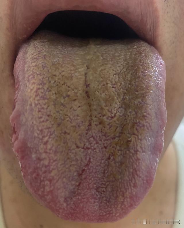 碰上这种患者，我简直头疼死了，生生就是不听话啊[发怒][发怒][发怒]
说了你要