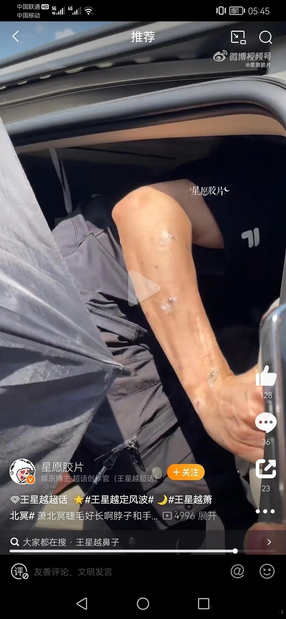 王星越这是怎么了呀，感觉胳膊有点吓人～ ​​​