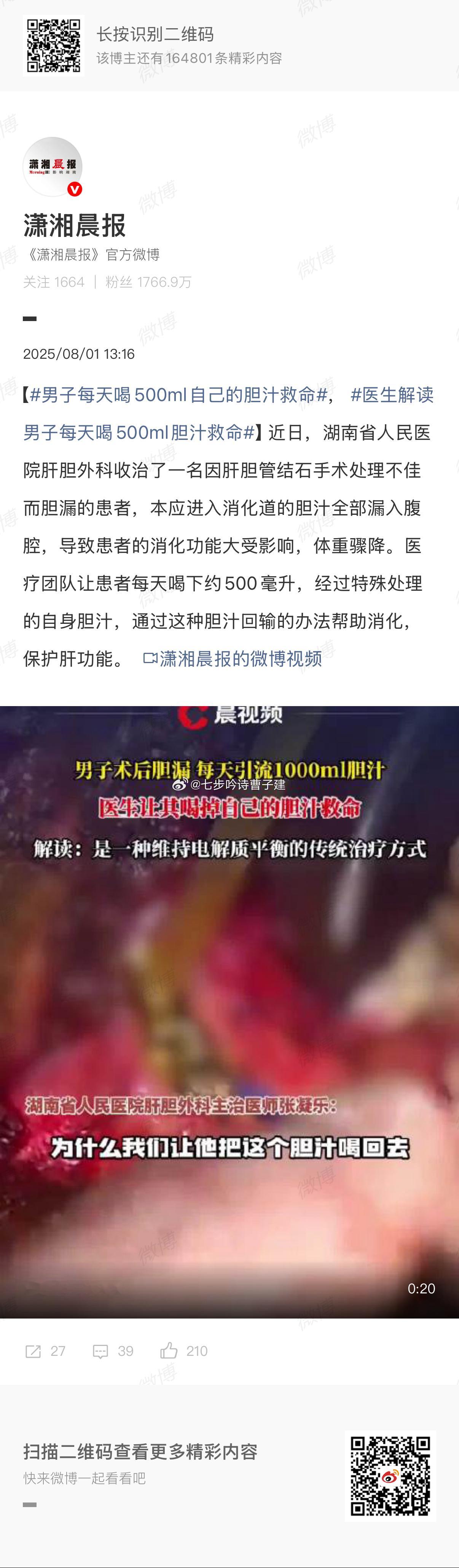 男子每天喝500ml自己的胆汁救命每个汉字都认识，但组合在一起就有点 ?_?，我