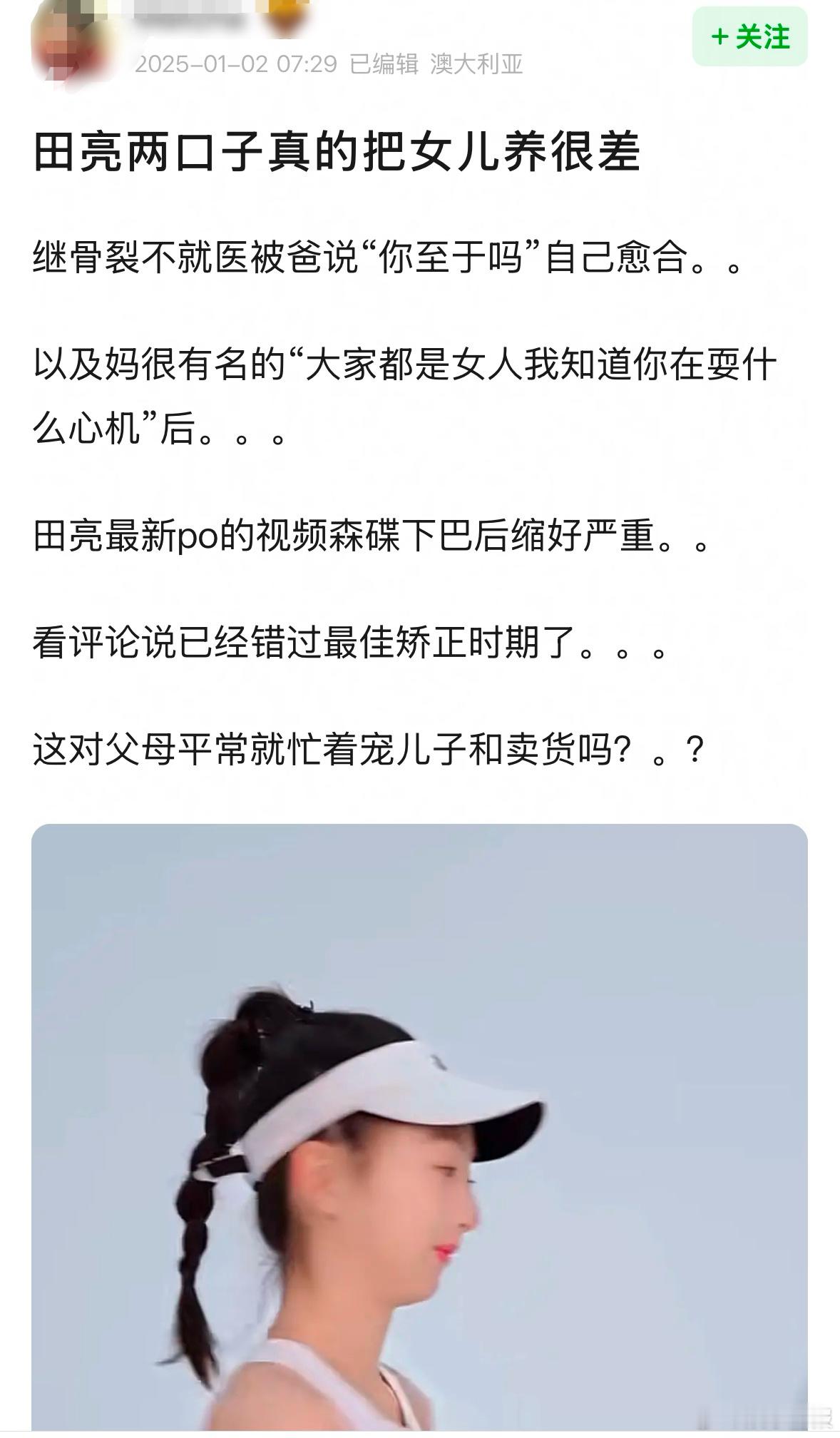 森碟下巴后缩严重 有网友发文发现森碟下巴后缩严重，已然错过了最佳治疗时机，并晒图