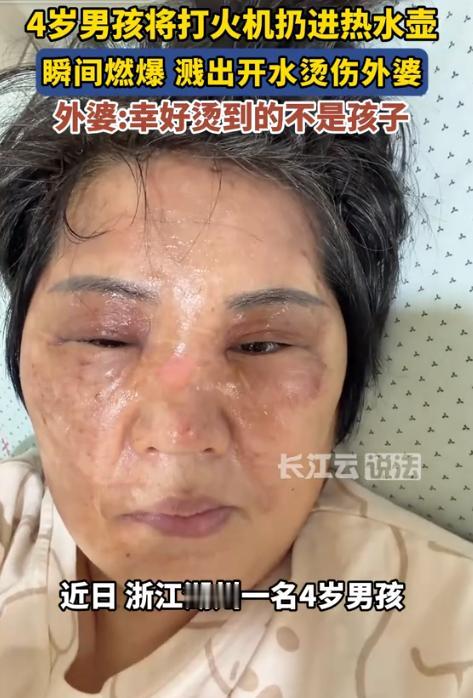 8月17日长江云说法报道，浙江湖州，4岁外孙趁大人没留神，把打火机丢进刚烧开的热