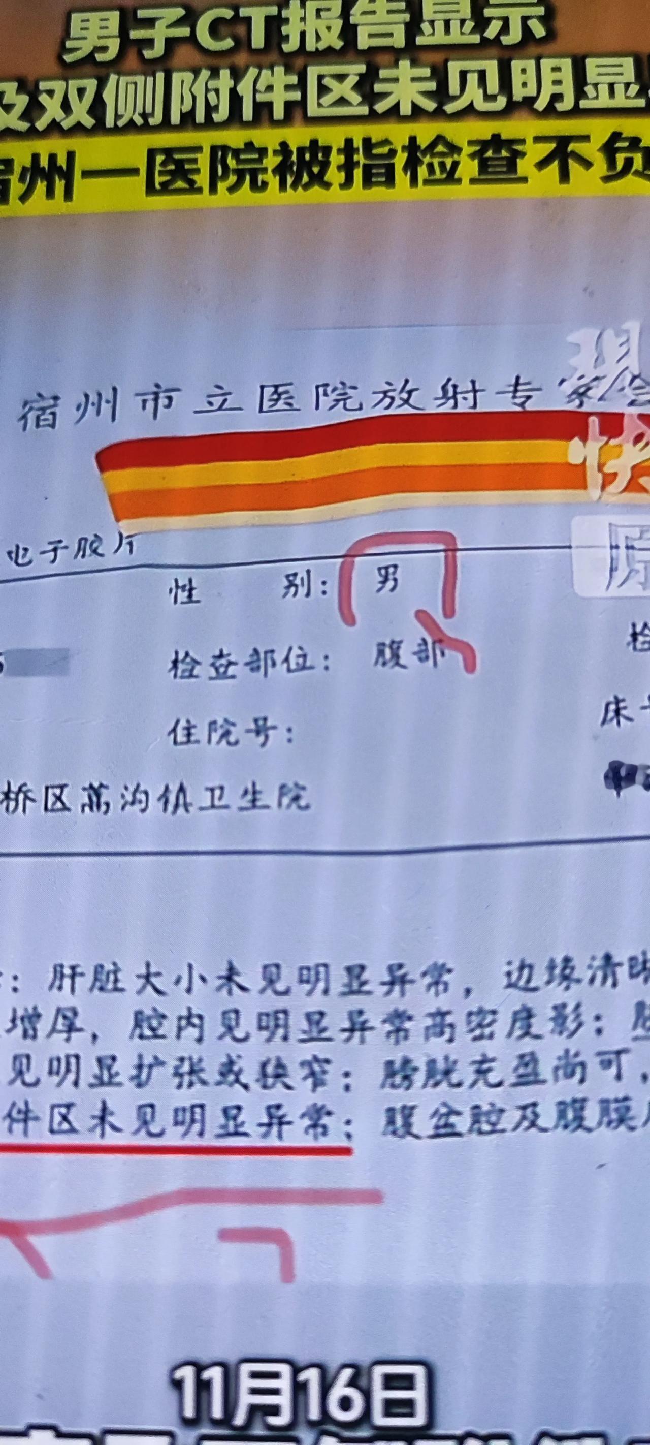 男人也长子宫？
三甲还是三假？
安徽宿州的张先生，做了个腹部CT。
拿到报告那一