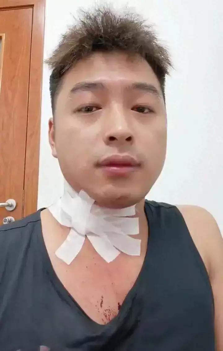 上海，一28岁男子深夜撸铁2小时后打车回家，随手拍死颈部蚊子并抓挠止痒，不料在车