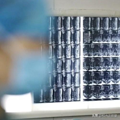 5种炎症可能变成癌症，别不当回事
 
很多人觉得炎症是小毛病，扛一扛就过去了，但