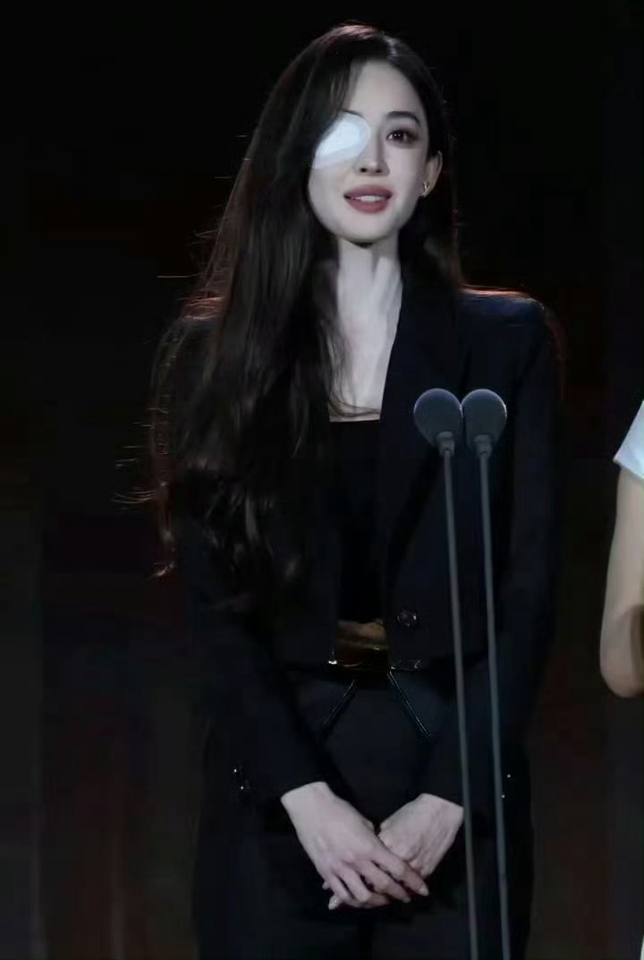 娜扎右眼贴纱布贴纱布都美出天际，娜扎简直美翻了