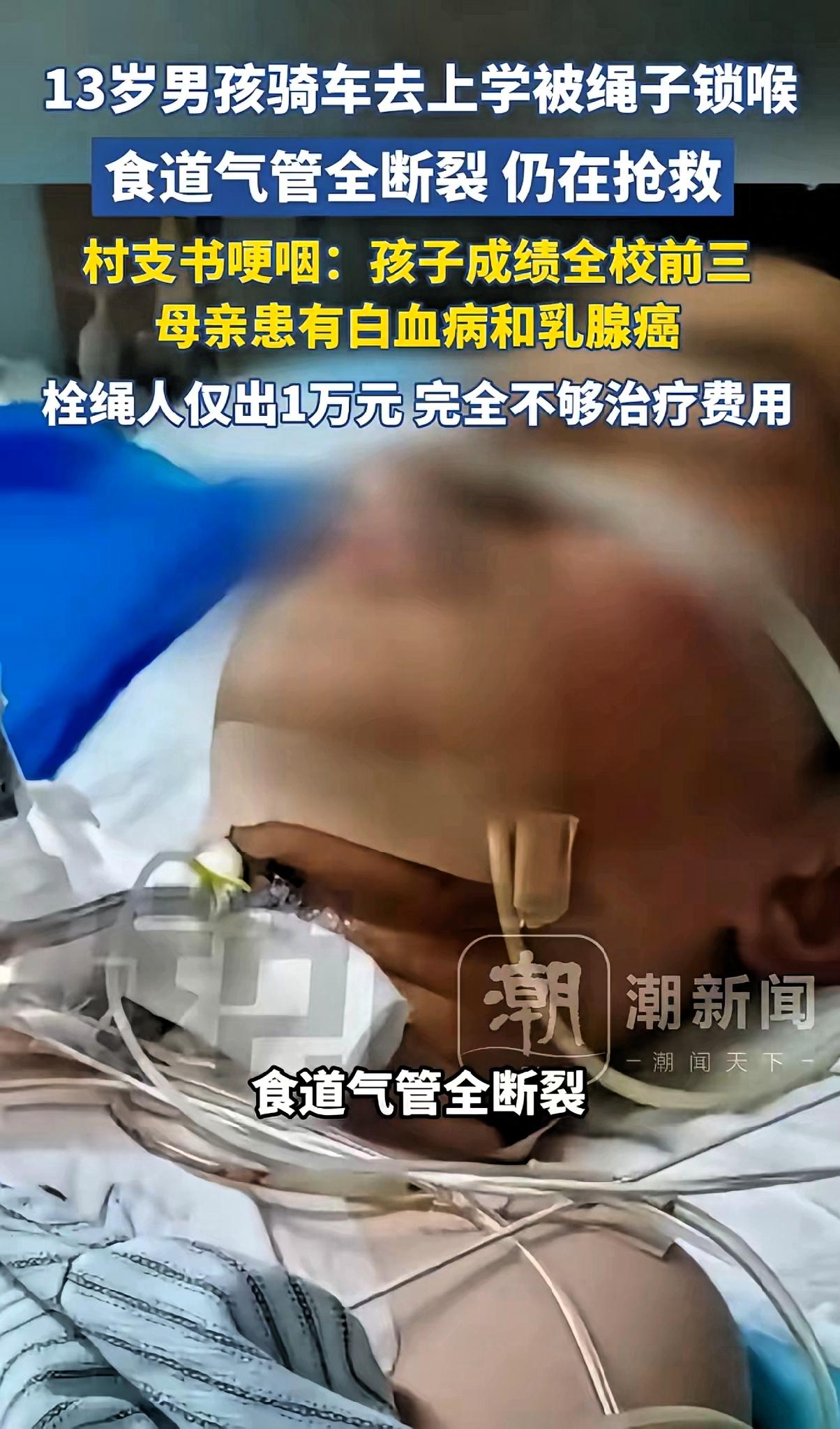 男孩骑车被绳叻倒伤势很重，律师发声！拴绳的老人恐难逃其责！

13岁男孩不仅听话